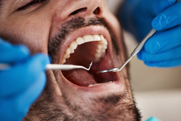 Emergency Dental Services in Lykens, PA